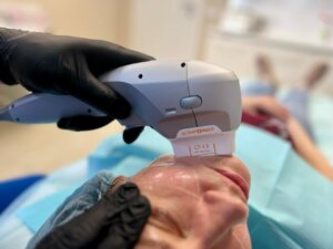 Что происходит в первые часы после SMAS лифтинга