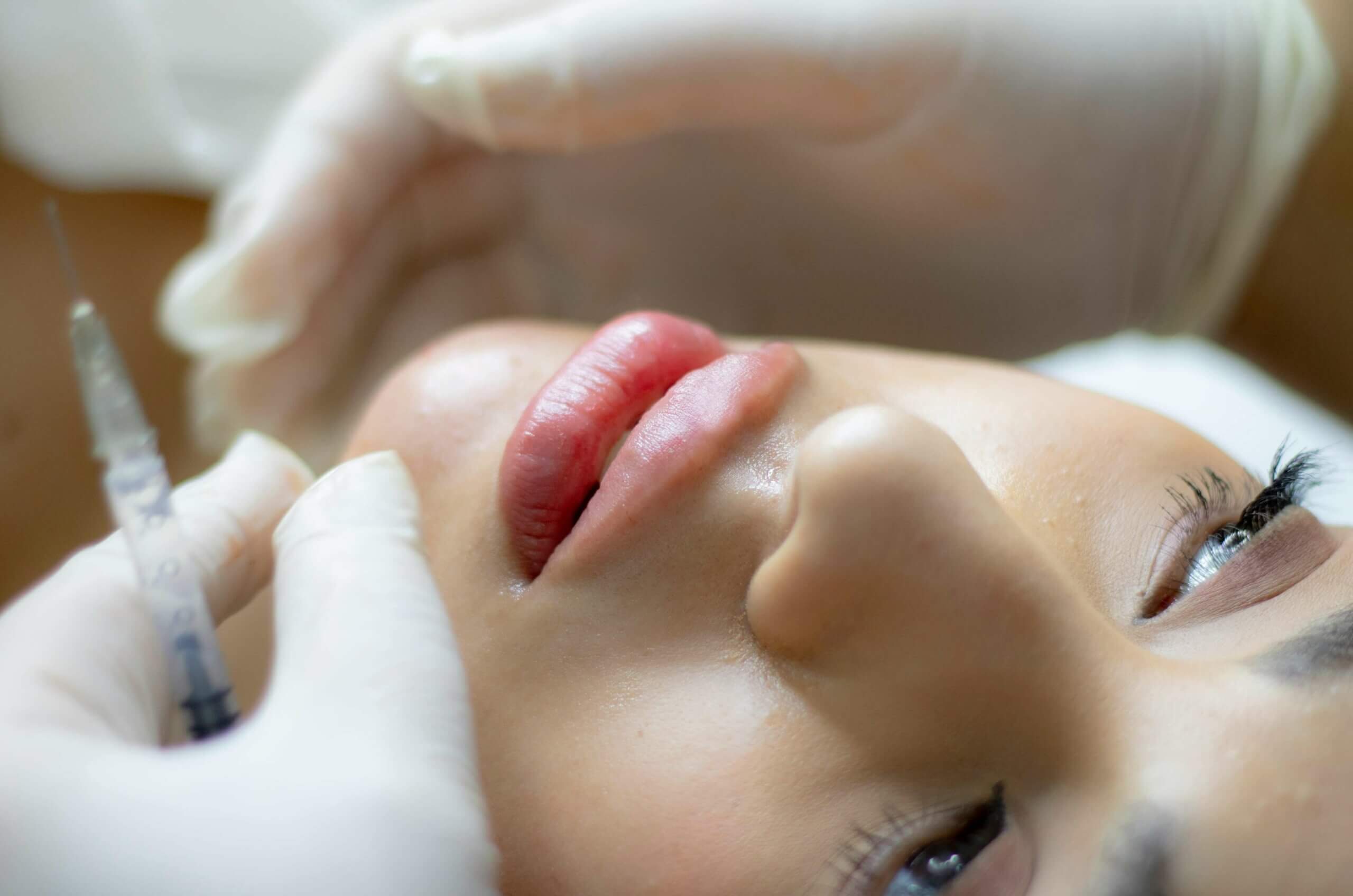 Формы после увеличения губ