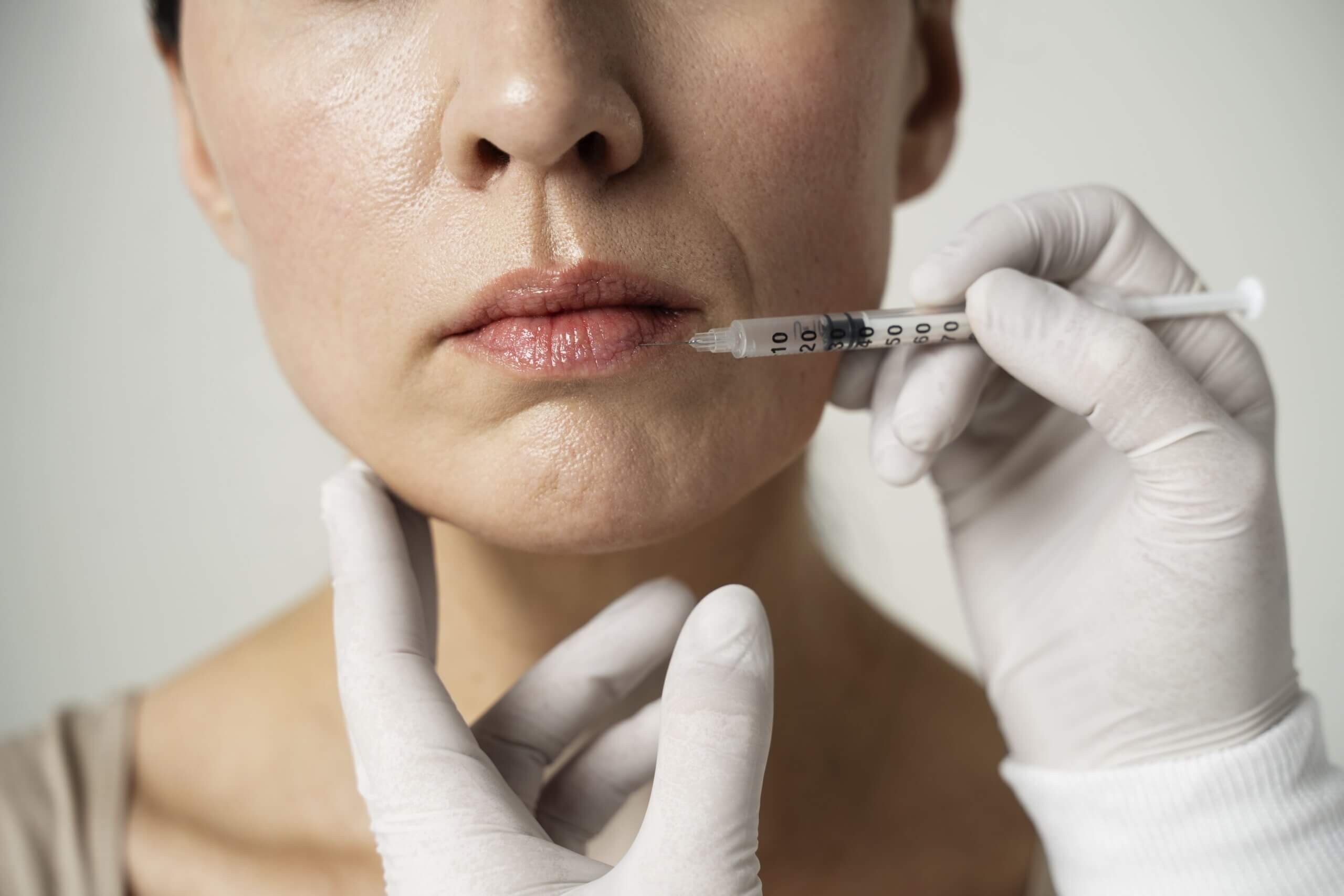 Убрать кисетные морщины над губой