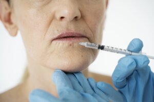 Убрать кисетные морщины над верхней губой